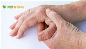 李蒔青醫師說明，患者發炎的關節通常少於3個，也可能出現像類風濕性關節炎有多發性關節炎的情形，兩側或單側發生。