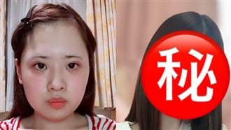 她砸「800萬日圓」整形！術後照驚呆網友