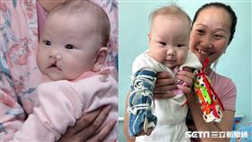 【蒙古專題】義診／記者張雅筑攝