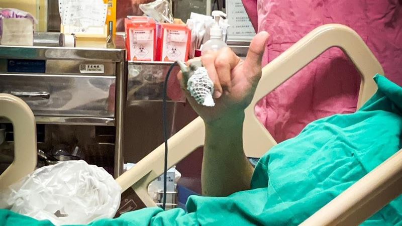 重傷勇消臉超腫　妻喊帥：快康復回來煮飯