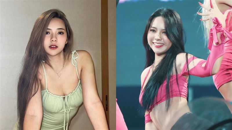 23歲女星罹多囊暴肥　跟家人借30萬做這事
