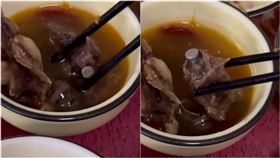 喝到「人肉湯」？內行曝：是骨科手術植入（圖／翻攝自微博）