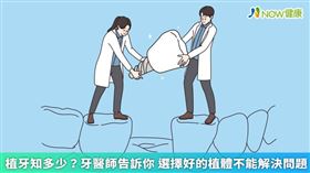 名家專用／牙醫師吳碧礽提醒，植牙不僅是為了美觀，還有助於維持口腔健康和營養的攝取，植牙後仍應定期回診，平時口腔清潔工作也不能馬虎，如此才能確保延長假牙的使用年限。（勿用）