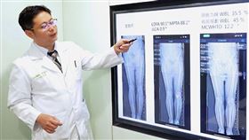 結合「3D列印技術」矯正變形腳踝 聯新國際醫曝有這些優點（圖／桃園電子報）