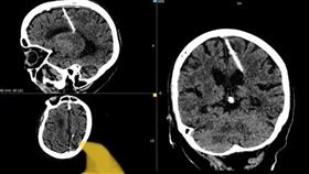 （圖／翻攝自庫頁島衛生部）