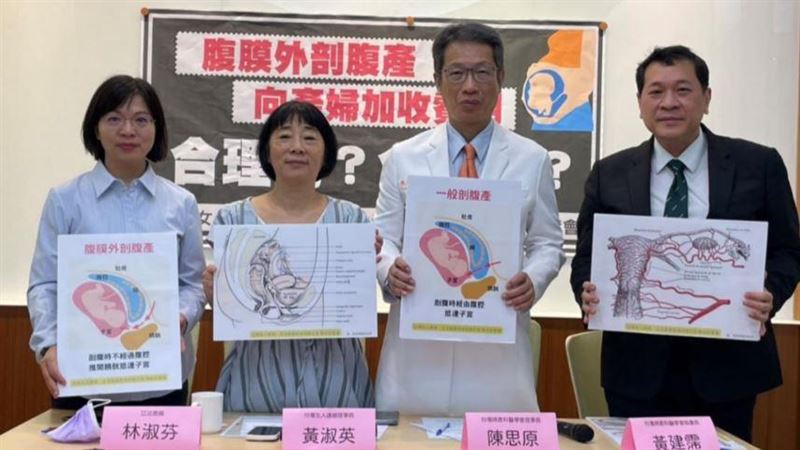 腹膜外剖腹產遭額外收兩萬！健保署說話了