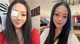 高慧君眼睛出狀況，眼球竟然位移。（圖／翻攝高慧君臉書）