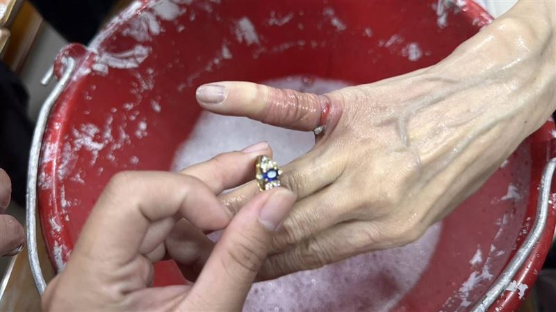 連2天民眾戒指卡住拔不下　消防2法寶解圍