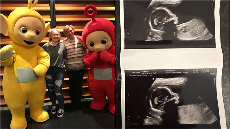 天線寶寶「太陽嬰兒」當媽了！曬超音波照