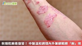 名家專用／秋季萬物收斂、氣候主燥，乾癬患者皮膚很容易出狀況，黃慶雲醫師提醒，應從日常生活作息和飲食習慣調整做起。（勿用）