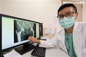 老婦動手術換髖關節仍痠痛　翻修找回腳力（圖／亞大醫院提供）