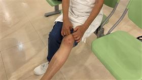 張阿姨去年底不慎跌倒，導致左膝關節軟骨缺損，接受軟骨前驅細胞修補術治療後狀況改善。（圖／記者簡浩正攝影）