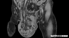 黃漢斌醫師授權提供