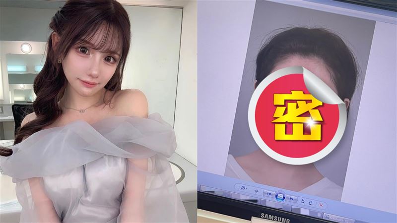 網紅狠砸4百萬變美女！驚人對比照差很大