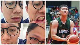 ▲羅振峰透露和前女友談分手未果，發生爭執遭動手臉部挫傷。（組合圖／翻攝自羅振峰IG）