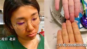 為減肥連吃3月紅蘿蔔…她慘變「小橘人」嚇壞　醫揭原因：被染色了