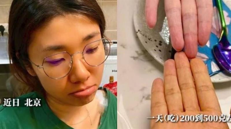 為減肥連吃3月紅蘿蔔　她慘變小橘人嚇壞