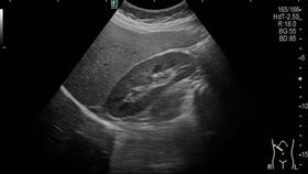 圖片來源：肝病防治學術基金會《好心肝》、節目提供、記者攝影