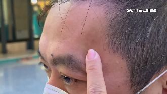 首起空中醫療暴力　受刑人直升機毆救護員