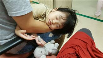 黴漿菌9QA解惑！醫點名2類人恐變嚴重肺炎