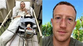 祖克柏格鬥練習時爆受傷，十字韌帶斷裂。（圖／翻攝自祖克柏 IG）