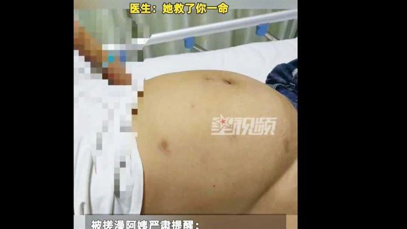 女大生「肚大像懷孕」搓澡阿姨1句話救命
