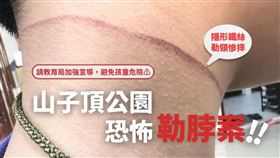 鐵絲,彈簧,勒喉,公園（圖／翻攝自我是平鎮人、桃園市議員王珮毓臉書）