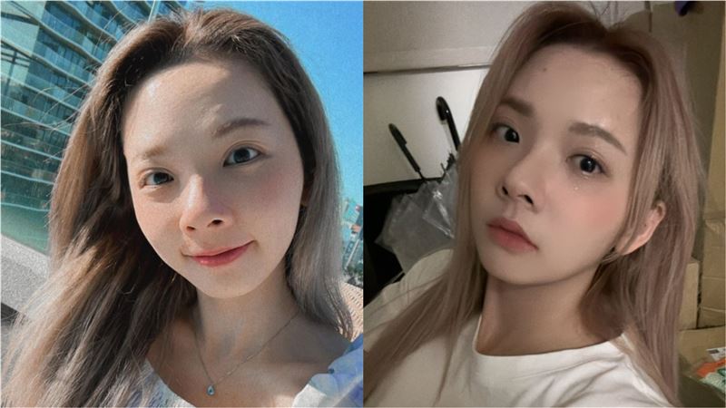 滴妹吐到送醫日本行急喊卡　瘀青照曝光