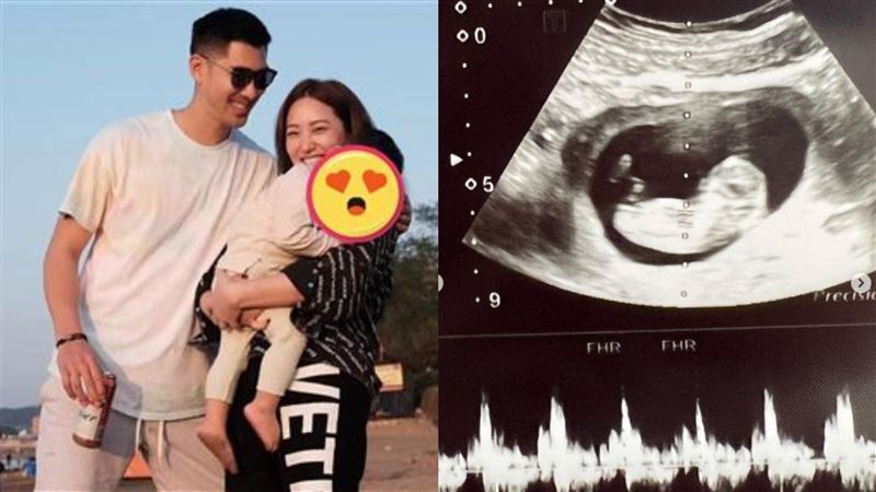 毛加恩老婆懷孕了　出血急停工安胎
