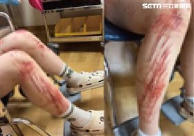 女體驗飛行傘2秒就墜落！雙腿驚悚傷勢曝（圖／翻攝畫面）