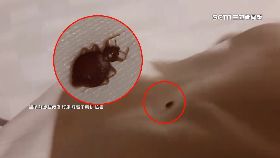 文 臭蟲入侵台1800