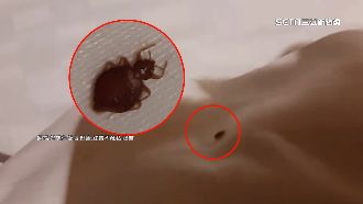 獨／肆虐港韓！民眾控北市旅館見臭蟲蹤跡