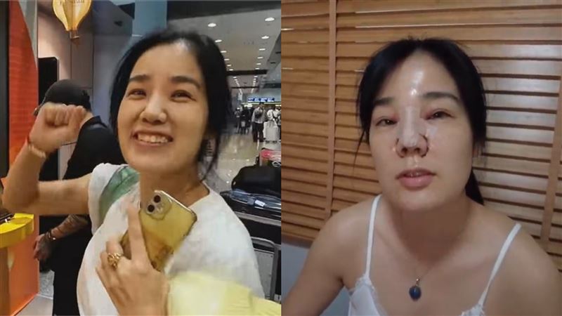 陸網紅老婆2年前泰國整形！他曝驚人花費