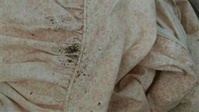 床蝨一口氣會連咬3包！昆蟲界「忍者吸血鬼」　奇癢難耐紅疹照曝光