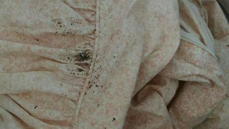 床蝨一次會咬3包 奇癢難耐紅疹照曝光