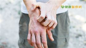 陳盈君醫師提到，健保在財政資源有限下，不得不規範分配資源，如果有快速改善症狀需求病人，在經濟條件許可下，也可主動與醫師諮詢，自費使用新型口服標靶小分子藥物。