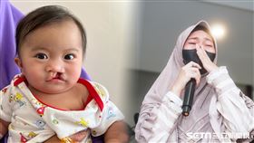 菲律賓義診／羅慧夫顱顏基金會授權提供