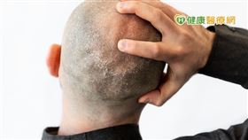 脂漏性皮膚炎在中醫稱作「面遊風」或「白屑風」，《外科正宗》:「白屑風多生於頭、面、耳、項髮中，初起微癢，久則漸生白屑，疊疊飛起，脫之又生