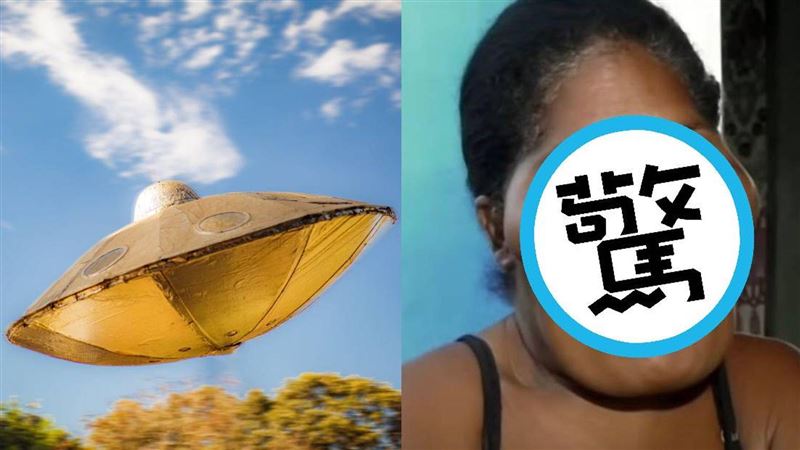 患神秘疾病遭罵：外星人　一家詭異外型曝