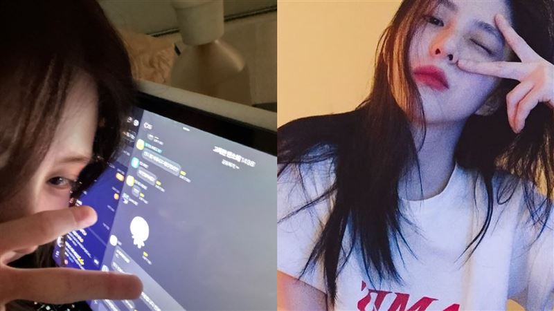 韓韶禧與粉絲聊天！認做這手術讓鼻子變高