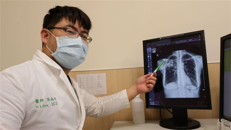 咳到不行不是感冒　肺部竟被啃了一個洞