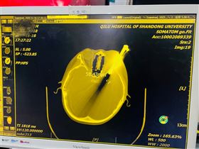 走路手中別拿東西！男童跌倒鑰匙插進腦中(圖/翻攝自青島半島)