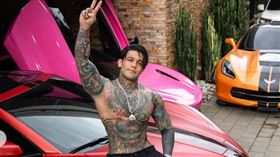 為增高10公分！帥哥網紅「花550萬打斷腿骨」現況曝光（圖／翻攝自Yeferson Cossio IG）