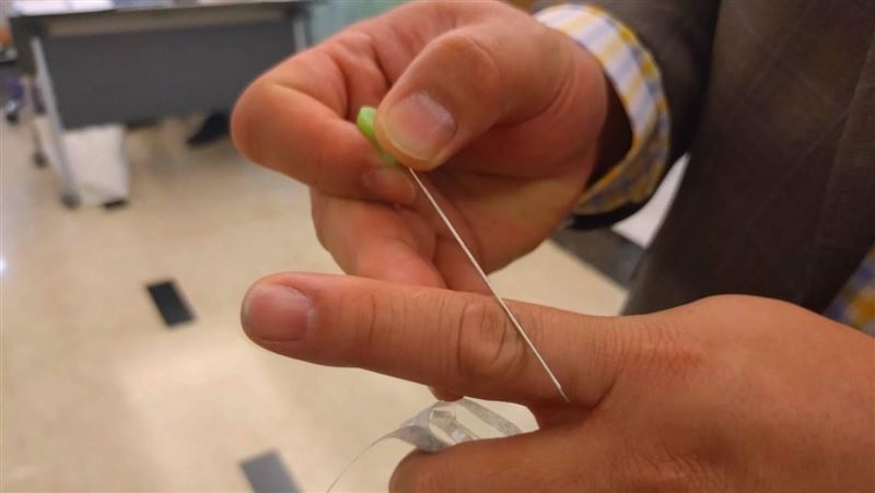 脖子壞掉釀耳鳴嗡嗡聲　中醫「針刀」奏效