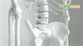 洗腎病患可能經常臥床，不容易注意到骨鬆常見矮與駝症狀，出現疼痛也不容易想到骨鬆。