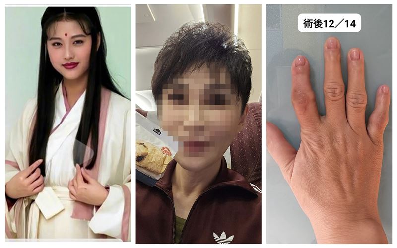 周海媚驟逝　她自爆也紅斑性狼瘡病況曝光