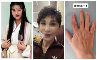 周海媚驟逝　她自爆也紅斑性狼瘡病況曝光