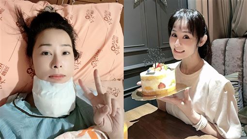 獨/本土女星罹癌開刀續命 大腸急切9息肉