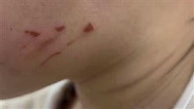 影／孫疑遭幼兒園師抓傷臉　阿公陳情淚崩（圖／桃園電子報）