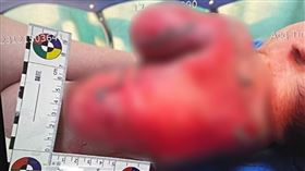 男嬰,竹市,燒燙傷,4星,泡牛奶,熱水,托嬰中心,爆料公社